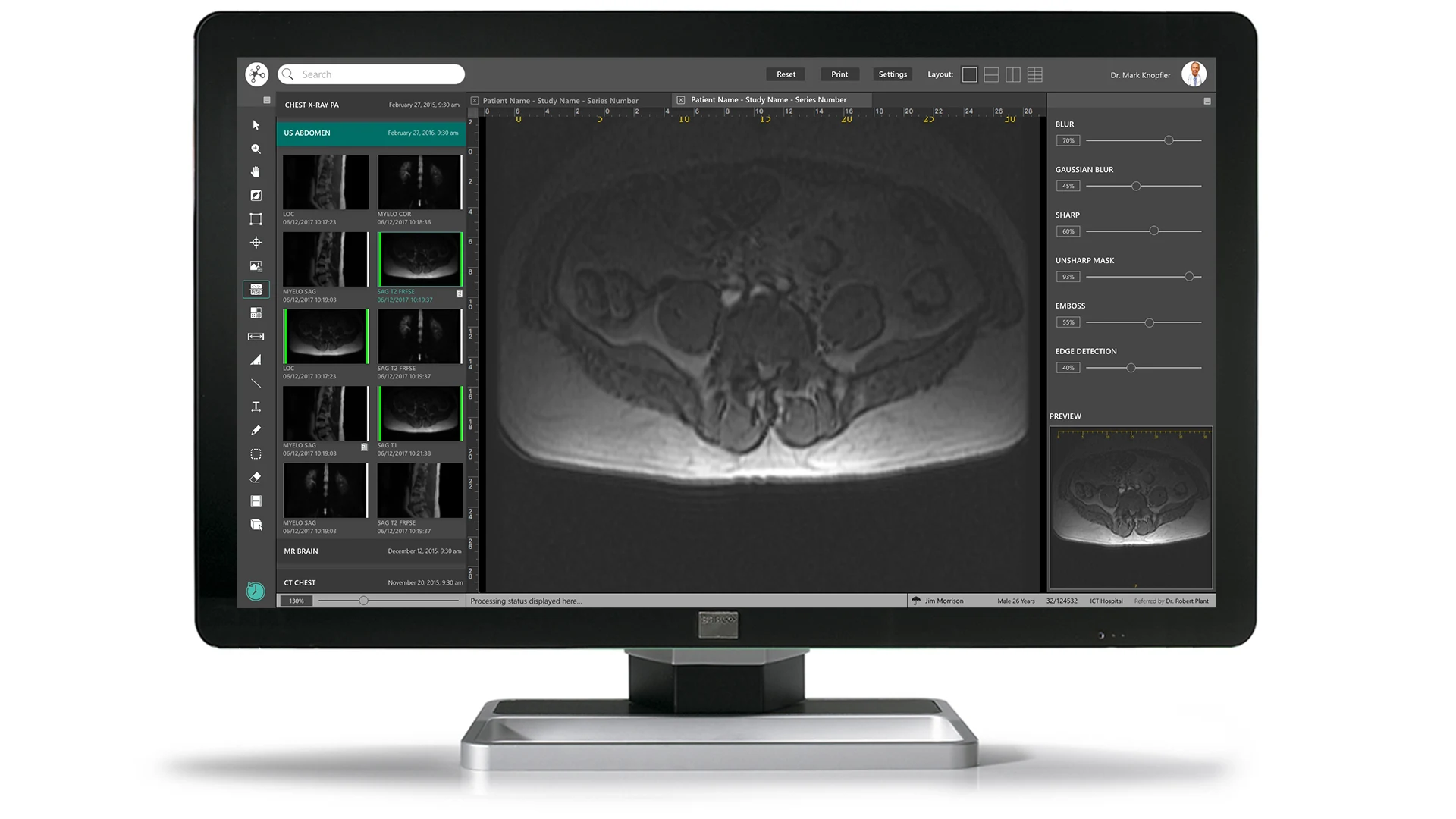 HINAI ImageNet RIS and PACS diagnostic workstation with MRI and CT series